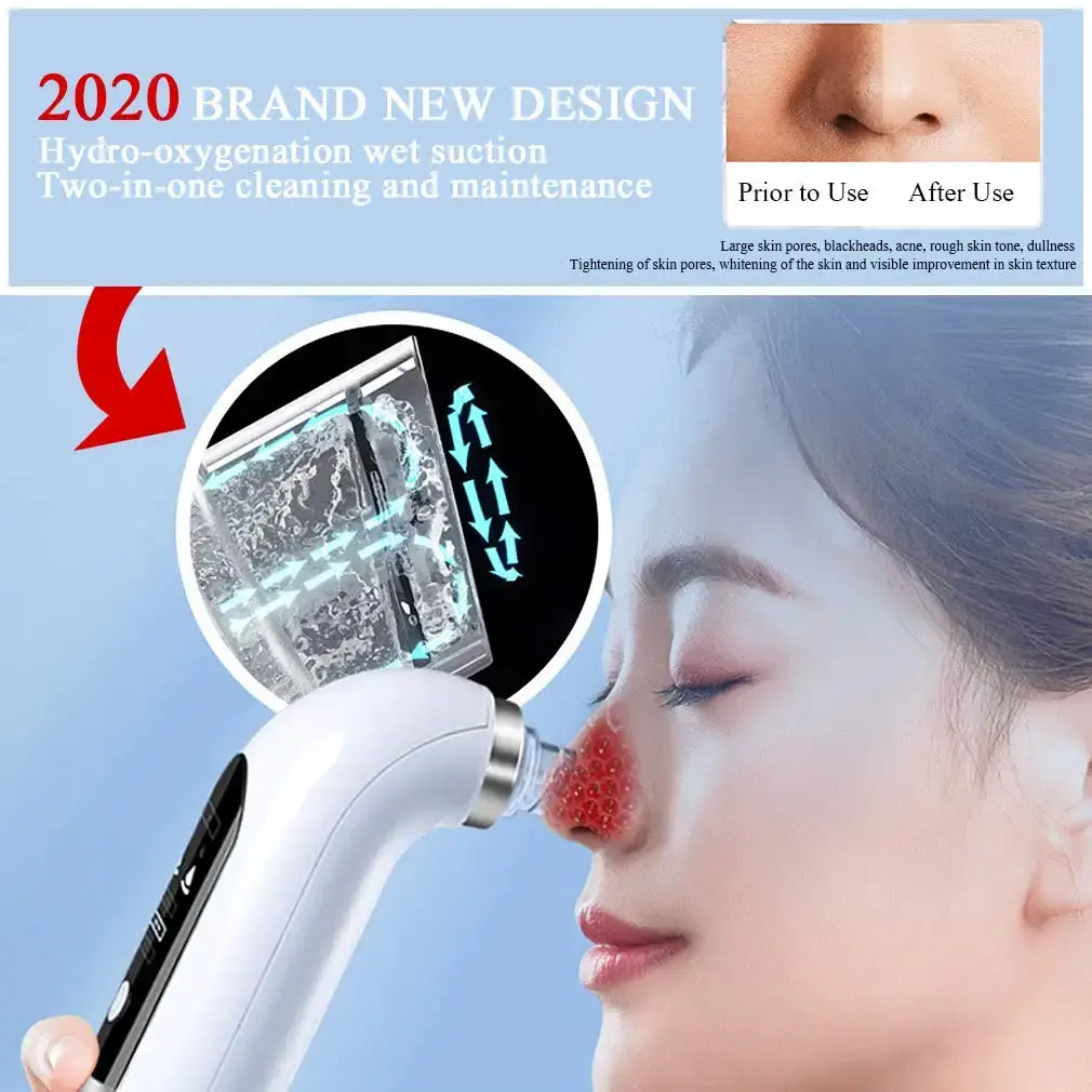 Dissolvant d'aspiration sous vide Blackhead