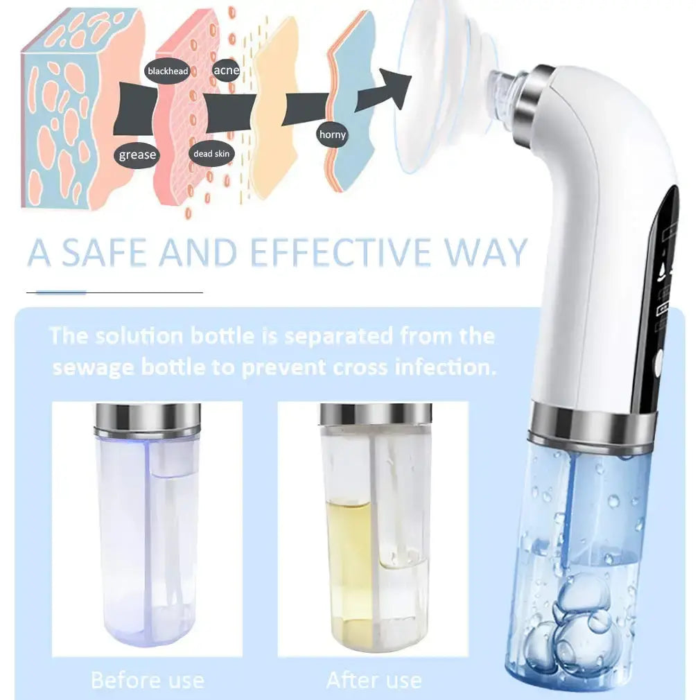 Dissolvant d'aspiration sous vide Blackhead